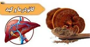 درمان گیاهی کبد چرب گرید 2
