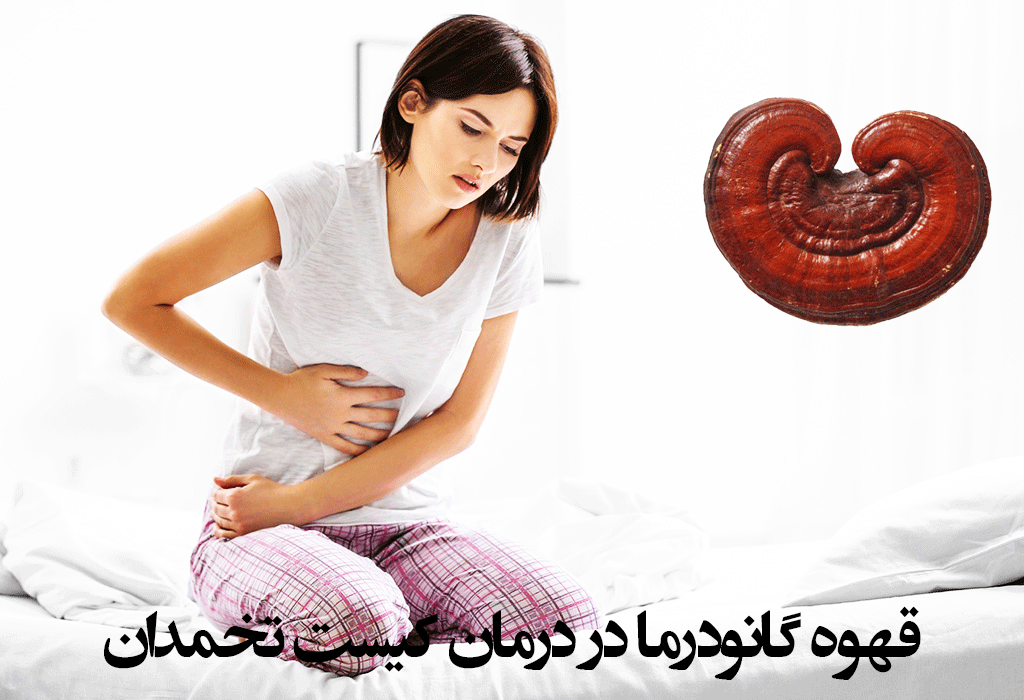 قهوه گانودرما برای کیست تخمدان