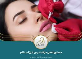 مراقبت های ضروری قبل و بعد از رژ لب دائم