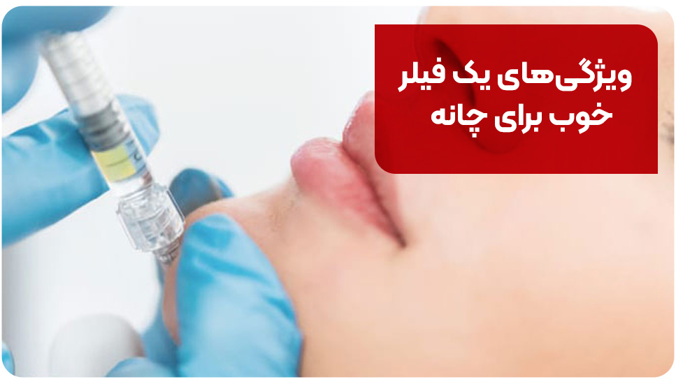 ویژگی&zwnj;های یک فیلر خوب برای چانه